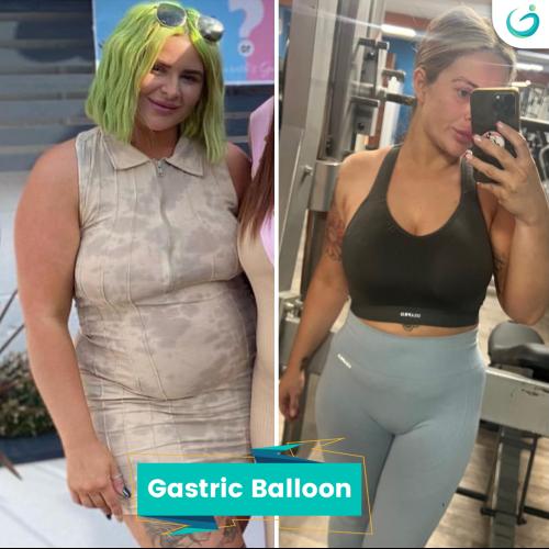 fotos antes y después de nuestros pacientes 0